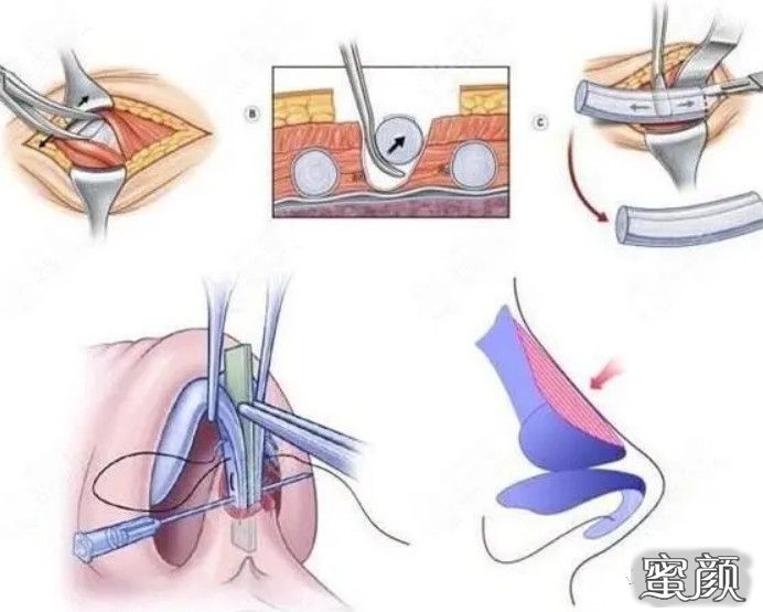 案例图片