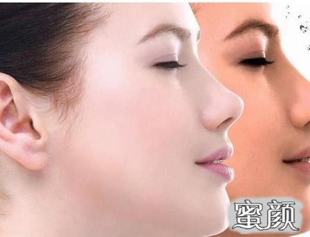 https://img.miyanlife.com/mnt/timg/230403/1K60W025-0.jpg