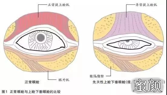 案例图片