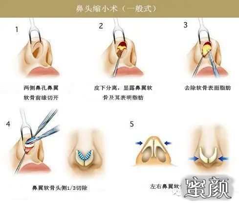 案例图片