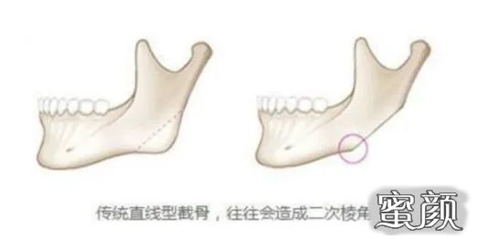 案例图片