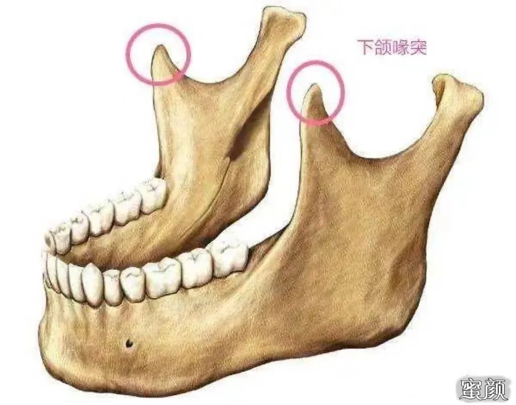 案例图片