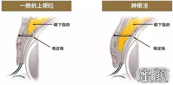 案例图片