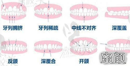 案例图片