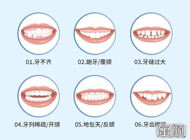 案例图片