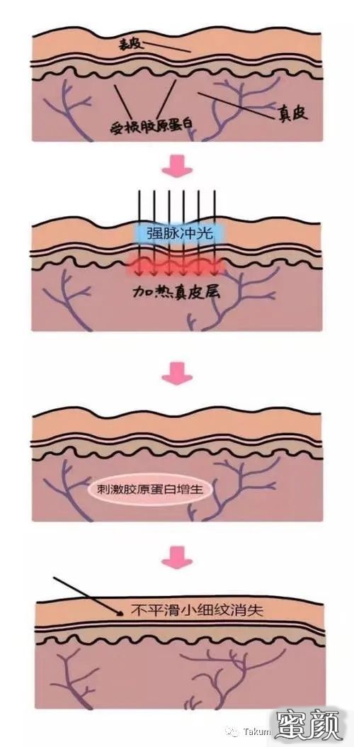 案例图片