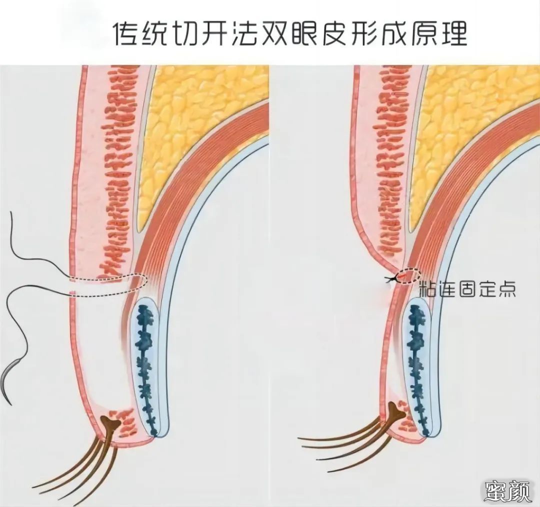 案例图片