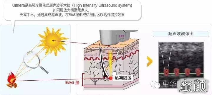 案例图片