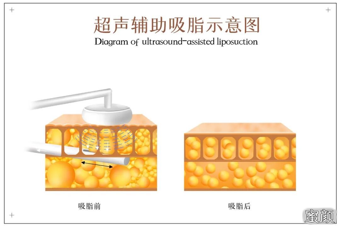 案例图片