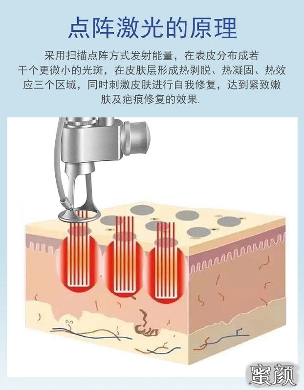 案例图片