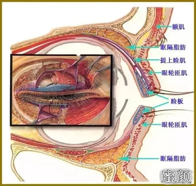 案例图片