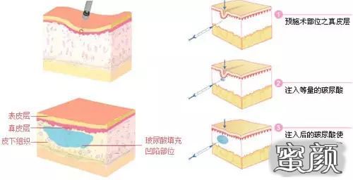 案例图片