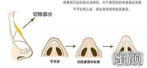 案例图片