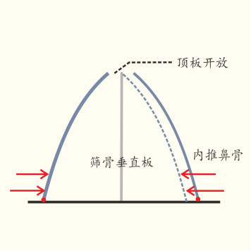 案例图片