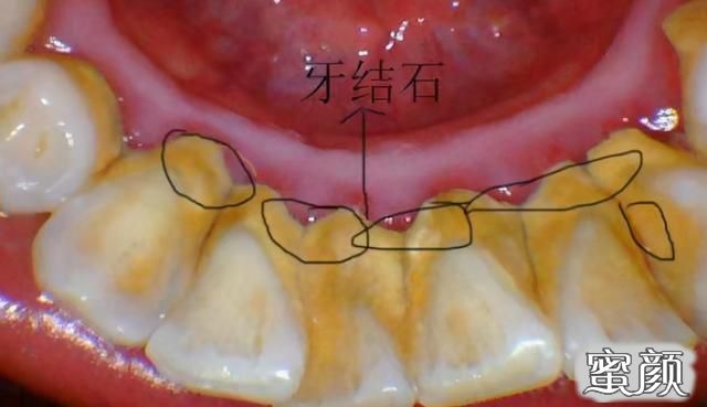 案例图片