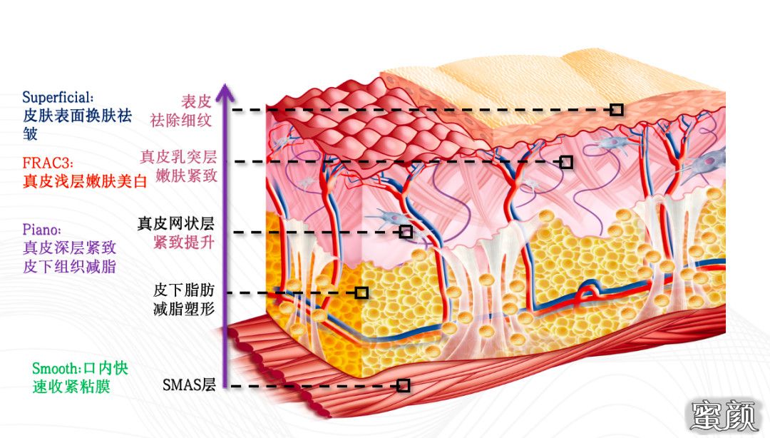 https://img.miyanlife.com/mnt/timg/230914/1JR1Cc-4.jpg