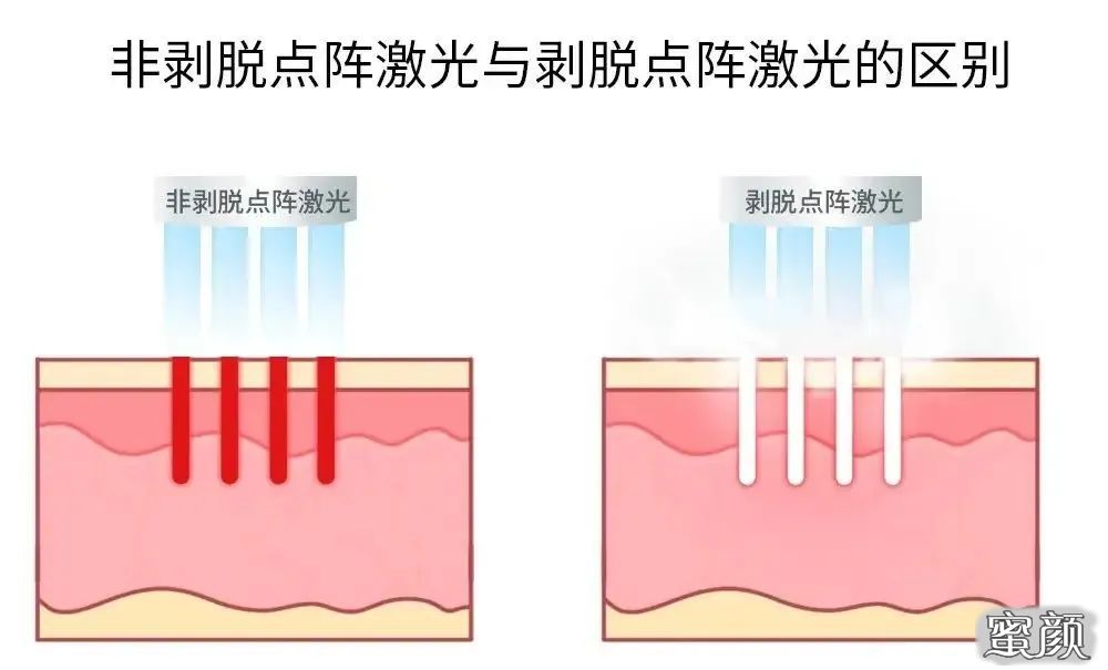 案例图片