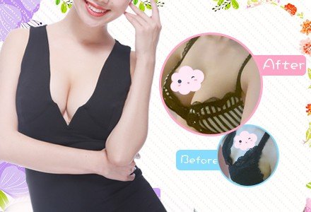 北京康寧硅膠假體隆胸-