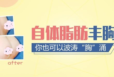 南昌自体脂肪丰胸-