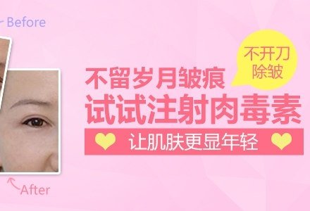 上海肉毒素除皱-