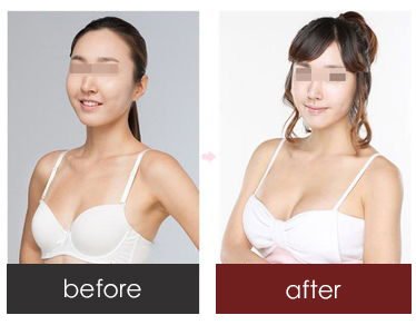 https://img.miyanlife.com/timg/160222/1G54443Z-0.jpg