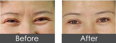 https://img.miyanlife.com/timg/160222/1I4043117-0.jpg