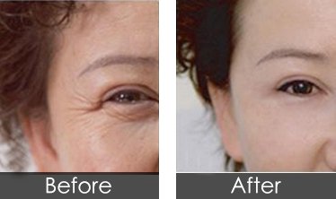 https://img.miyanlife.com/timg/160222/1I4055095-1.jpg