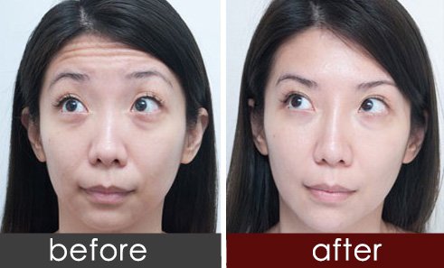 https://img.miyanlife.com/timg/160222/1I53K433-0.jpg