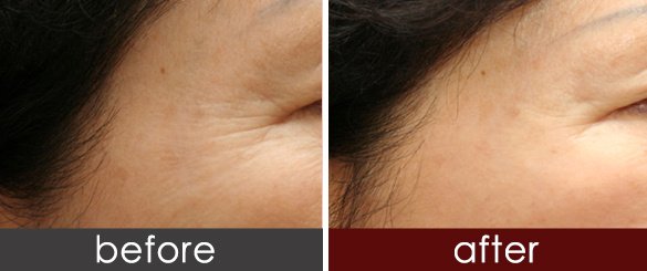 https://img.miyanlife.com/timg/160222/1I55I418-0.jpg