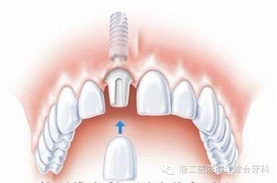 案例图片