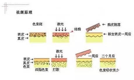 案例图片