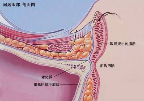 案例图片