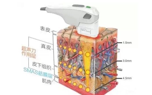 案例图片