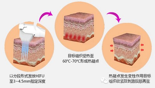 案例图片