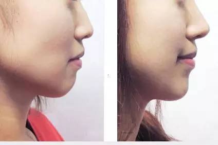 https://img.miyanlife.com/timg/160606/1S4214194-8.jpg