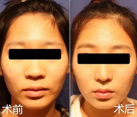 https://img.miyanlife.com/timg/160612/2306113O4-2.jpg