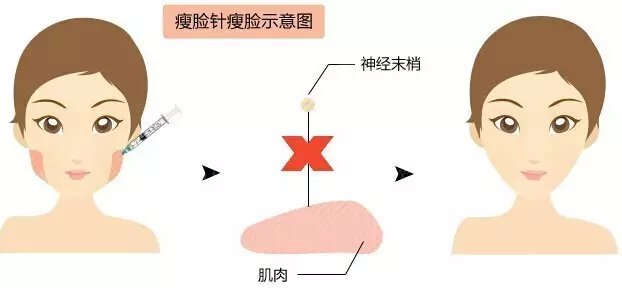 https://img.miyanlife.com/timg/160613/0114453W7-8.jpg