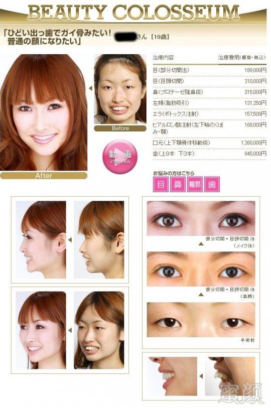 https://img.miyanlife.com/timg/160619/2131202S0-13.jpg