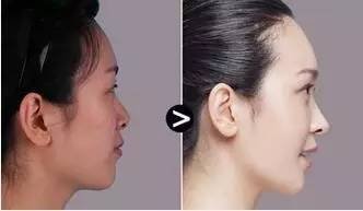 https://img.miyanlife.com/timg/160620/19331L153-12.jpg