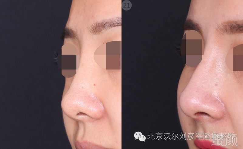 https://img.miyanlife.com/timg/160621/1504134254-5.jpg