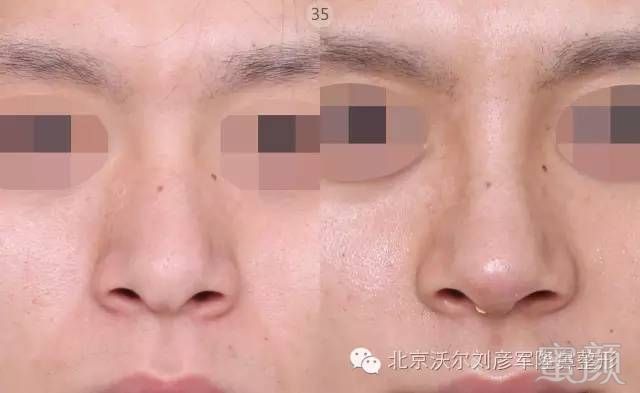 https://img.miyanlife.com/timg/160621/1504141252-7.jpg