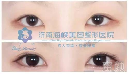 https://img.miyanlife.com/timg/160621/20431113C-2.jpg