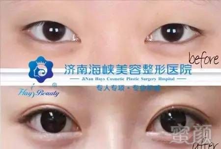 https://img.miyanlife.com/timg/160621/2043112M1-1.jpg