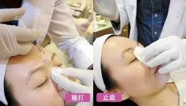 https://img.miyanlife.com/timg/160622/21541014X-0.jpg