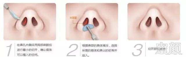 https://img.miyanlife.com/timg/160622/2154133646-3.jpg
