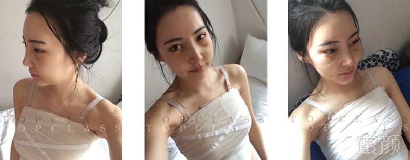 https://img.miyanlife.com/timg/160623/1921163414-1.jpg