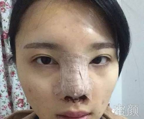 https://img.miyanlife.com/timg/160625/201J05543-1.jpg
