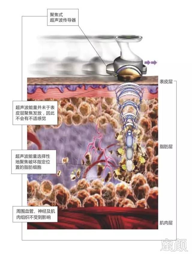 案例图片