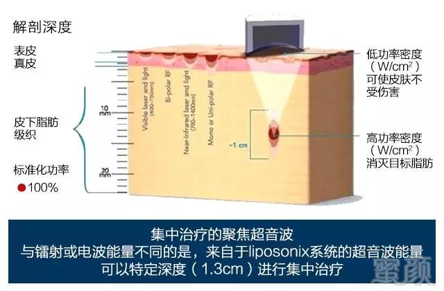 案例图片