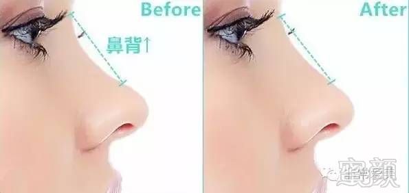 https://img.miyanlife.com/timg/160626/2046455a4-7.jpg